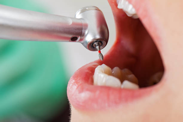 Best Emergency Treatment for Toothache in Willmsburg, IA